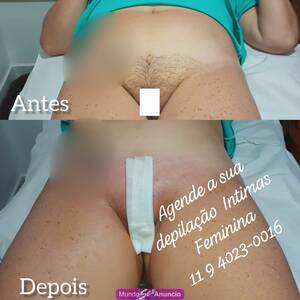 Depilador Homem Depilações intima  P/ mulheres.  zona lest