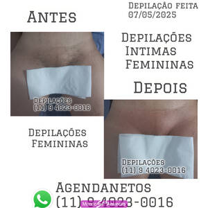 Luiz Depilações intimas para mulheres  11 9 4023-0016  zon