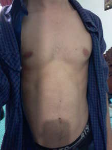 Sexo casual Medellin