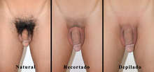 depilacion de varones activos al 100%.y sexo medellin