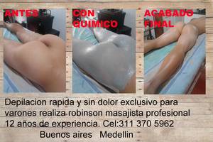 depilarte.servicio solo para varones en medellin