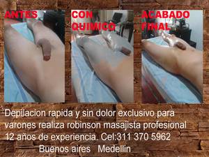 depilo varones,corporal incluyendo genitales y gluteos.mede