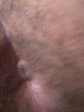 CULO PELUDO