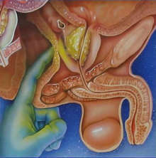ORGSMO PROSTATICO