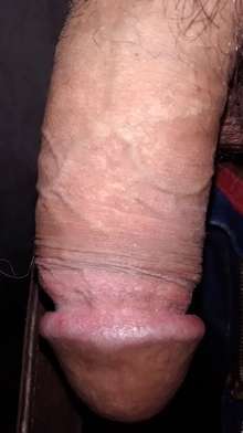 Chico Caliente