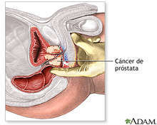 MASAJE PROSTATICO cuento con lugar